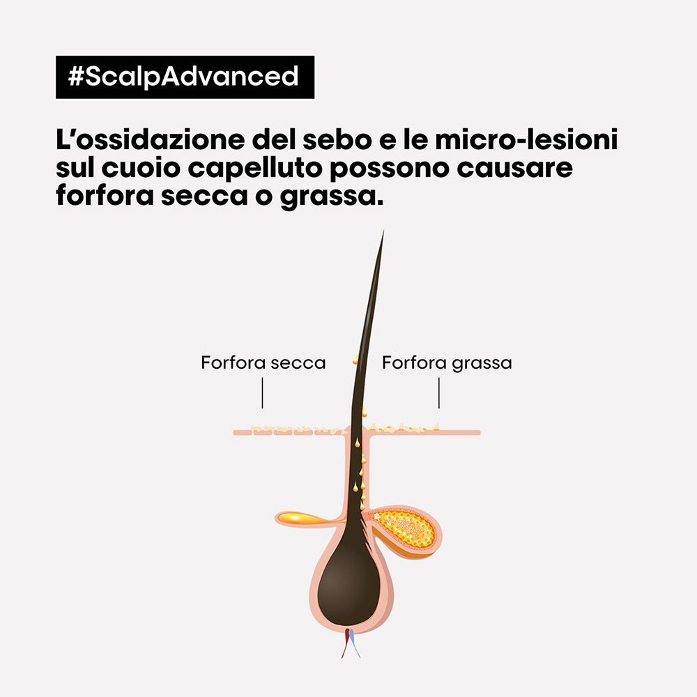 L'oreal Professionnel Scalp Advanced Anti-Dandruff-2