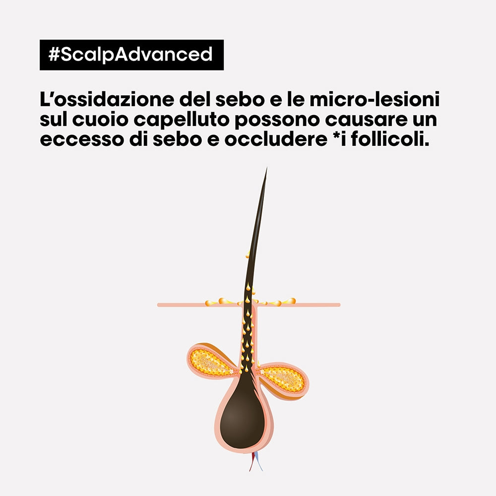 L'oreal Professionnel Scalp Advanced Anti-Oiliness-2