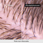 L'oreal Professionnel Scalp Advanced Anti-Oiliness-4