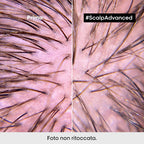 L'oreal Professionnel Scalp Advanced Trattamento Intense Soother Anti-Discomfort-4