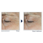 Roc Derm Correxion Soin Duo Contour Des Yeux-4